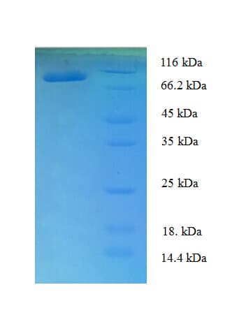 Human TBX18 Protein (Recombinant His-SUMO)