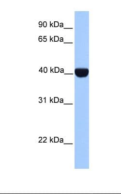 Polyclonal Rabbit anti-Human CSNK2A2 Antibody (aa251-300, IHC, WB)