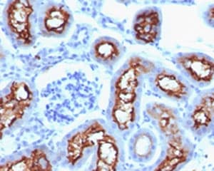 CFTR Antibody (clone CFTR1-1)