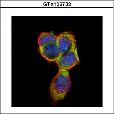 CEACAM5 / CD66e Antibody (aa395-702)
