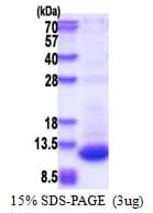 Human DPH3B Protein (Recombinant His)
