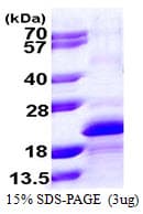 Human MYLPF Protein (Recombinant His)