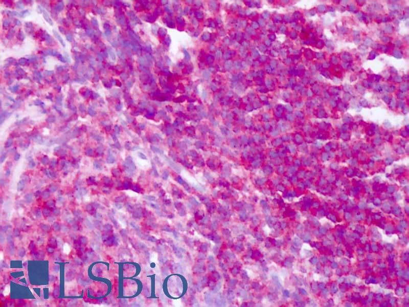 IHC-plus™ Polyclonal Rabbit anti-Human CD45 / LCA Antibody (Internal, IHC)