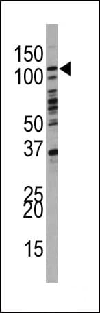 PIK3C3 / VPS34 Antibody (aa9-41)