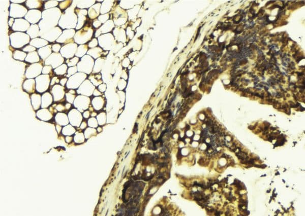 PIBF1 / PIBF Antibody