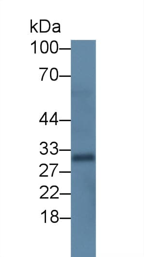 SCGB1A1 / Uteroglobin Antibody (clone C2)