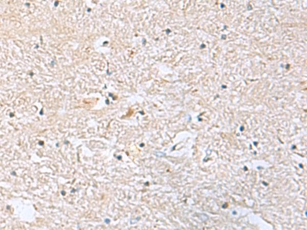 Polyclonal Rabbit anti-Human EIF4A2 Antibody (IHC)