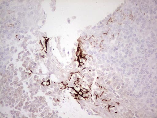 ABCB1 / MDR1 / P Glycoprotein Antibody (aa995-1280, clone OTI11D2, Carrier-free)