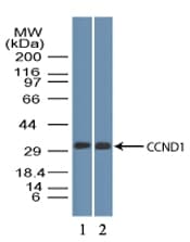 PathPlus™ Polyclonal Rabbit anti-Human CCND1 / Cyclin D1 Antibody (aa250-300, IHC, WB)