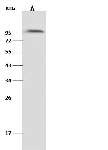 HGF / Hepatocyte Growth Factor Antibody (Preservative Free)