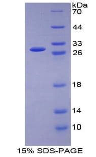 Rat GSR / Glutathione Reductase Protein (Recombinant His-T7)