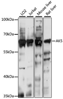 AK5 / Adenylate Kinase 5 Antibody