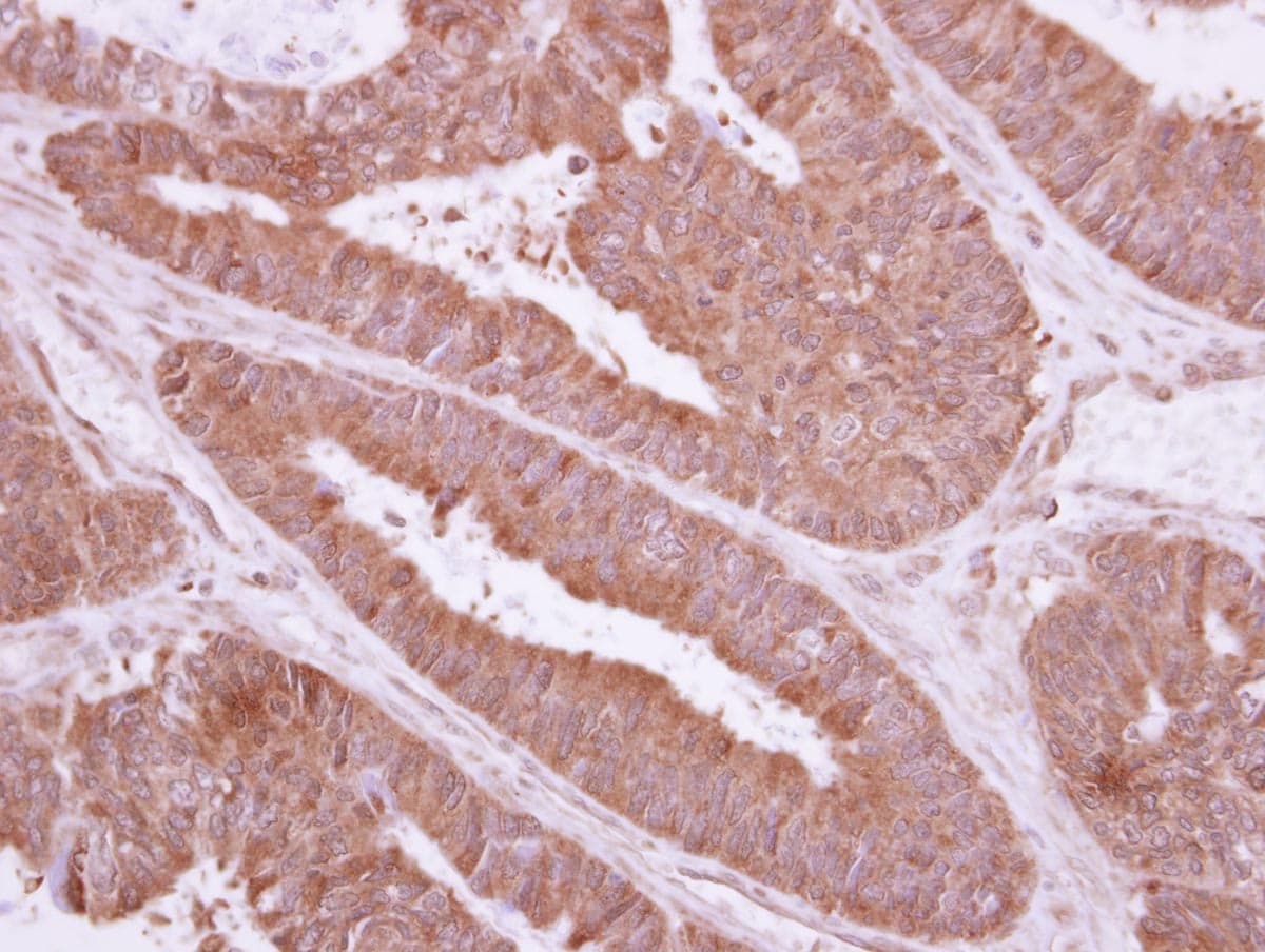 Polyclonal Rabbit anti-Human NME9 / TXNDC6 Antibody (IHC, WB)