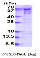 Human YY1 Protein (Recombinant His)