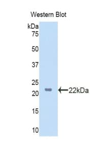 LSS Antibody (aa388-549)