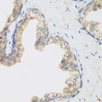 NCBP2 / CBP20 Antibody