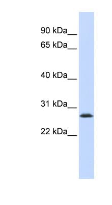Polyclonal Rabbit anti-Human LSM12 Antibody (C-Terminus, WB)