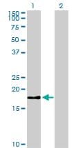 BIRC5 / Survivin Antibody (clone 5B10)