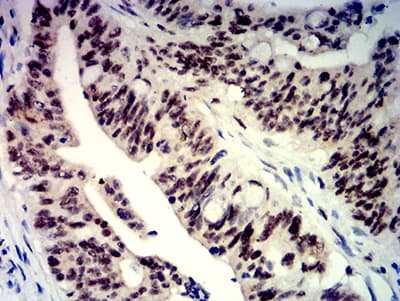 BTRCP / BETA-TRCP Antibody (clone 3D5E6)