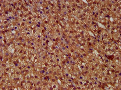 Polyclonal Rabbit anti-Human MICU1 / CBARA1 Antibody (IHC, WB)