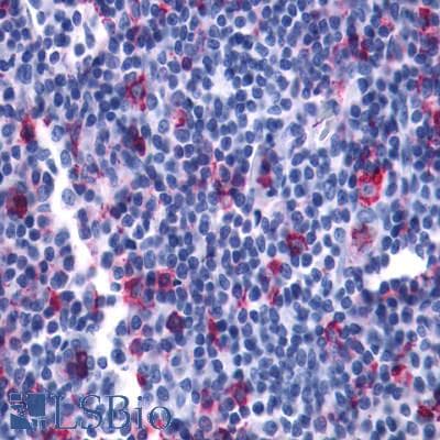 PathPlus™ Polyclonal Rabbit anti-Human LTB4R2 / BLT2 Antibody (C-Terminus, IHC)