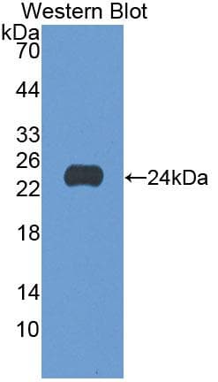 GAA / Alpha-Glucosidase, Acid Antibody (aa70-245)