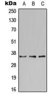 IHC-plus™ BST2 Antibody (Internal)