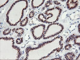 GOLM1 / GP73 / GOLPH2 Antibody (clone OTI2D6)