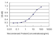 Monoclonal Mouse anti-Human AMBP Antibody (clone 3F1, IF, WB)