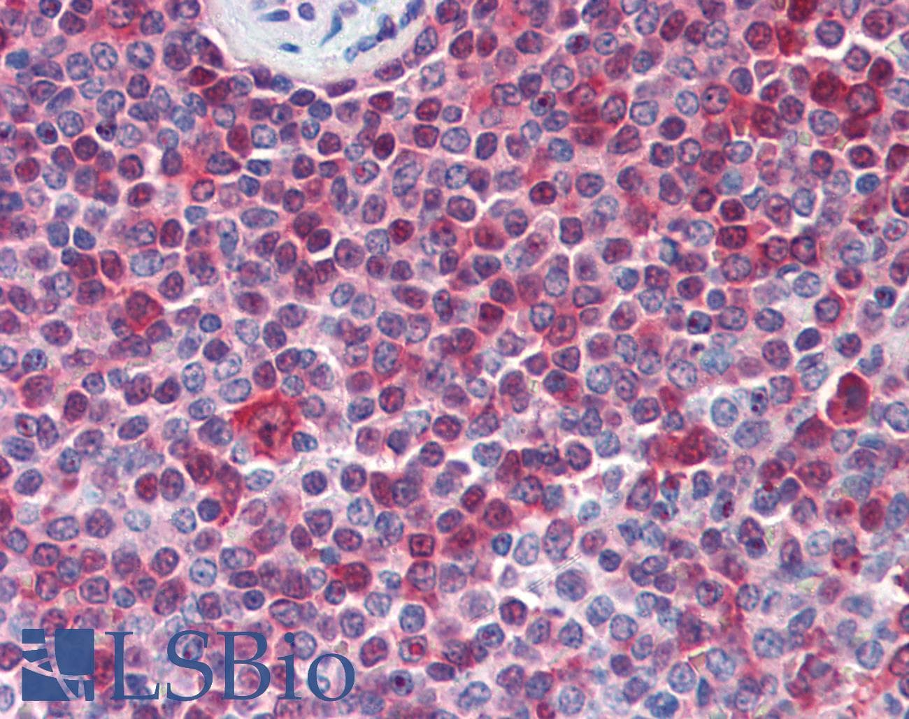 IHC-plus™ PARP1 Antibody (N-Terminus)
