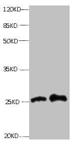 Monoclonal Mouse anti-Human RBP4 Antibody (WB)