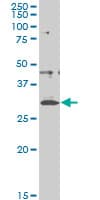 Monoclonal Mouse anti-Human CITED1 Antibody (clone 5H6, IHC, WB)