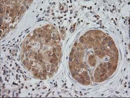 MAPRE2 / EB2 Antibody (clone OTI5F3)