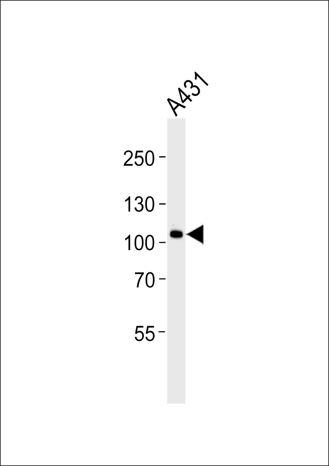 Polyclonal Rabbit anti-Human CTNND1 / p120 Catenin Antibody (Tyr174, WB)