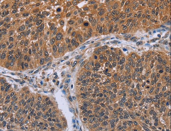 IHH Antibody