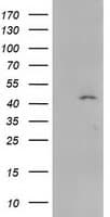 SERPINB4 / SCCA1+2 Antibody (clone OTI4C8)