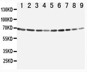 ANXA6/Annexin A6/Annexin VI Antibody (aa636-652)