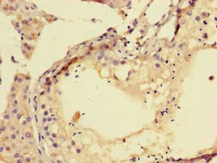 TPPP3 Antibody