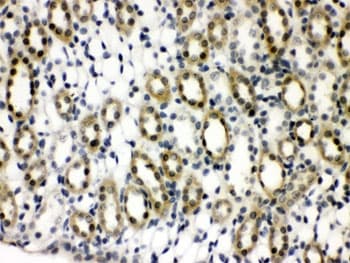 Polyclonal Rabbit anti-Human PTPN2 / TC-PTP Antibody (IHC, WB)