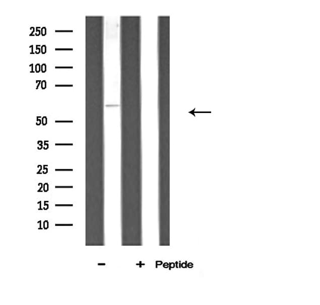 Polyclonal Rabbit anti-Human ATP5A1 / ATP Synthase Alpha Antibody (IF, WB)
