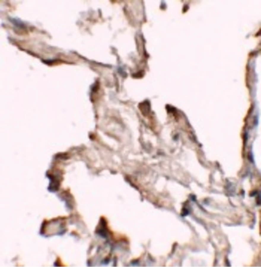 NBN / Nibrin Antibody