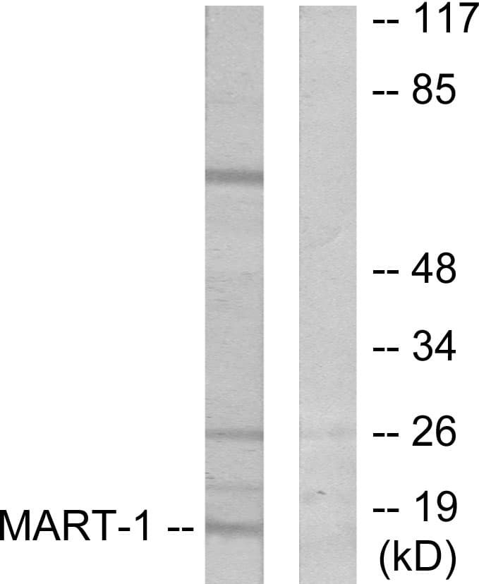 MLANA / Melan-A Antibody (aa41-90)