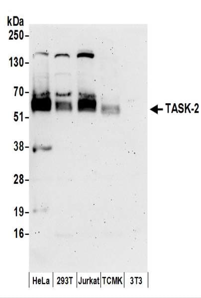 KCNK5 / TASK2 Antibody (aa459-499)