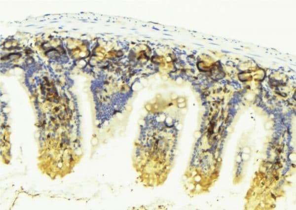 Polyclonal Rabbit anti-Human VEGFD Antibody (IHC, WB)
