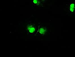 STK39 / SPAK Antibody (clone OTI3C12)