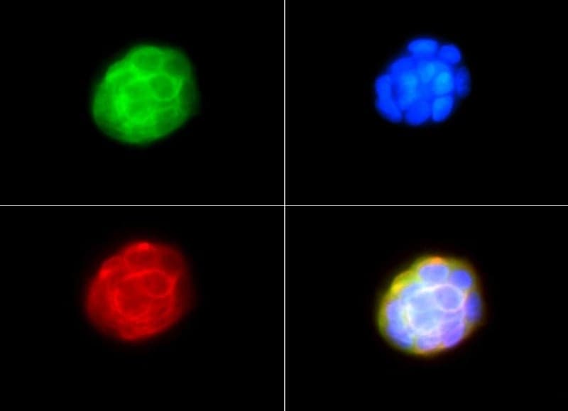 NFKB1 / NF-Kappa-B Antibody