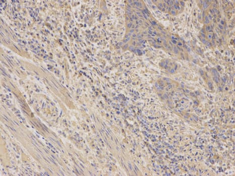 IHC-plus™ DDX / AKR1C3 Antibody