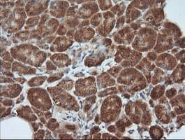 MAP2K1 / MKK1 / MEK1 Antibody (clone OTI7E2)