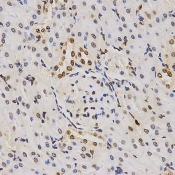 Histone H3 Antibody (Tri-Methyl-Lys79)