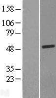 LACC1 Protein (Over-Expression Lysate Myc-DDK (Flag))